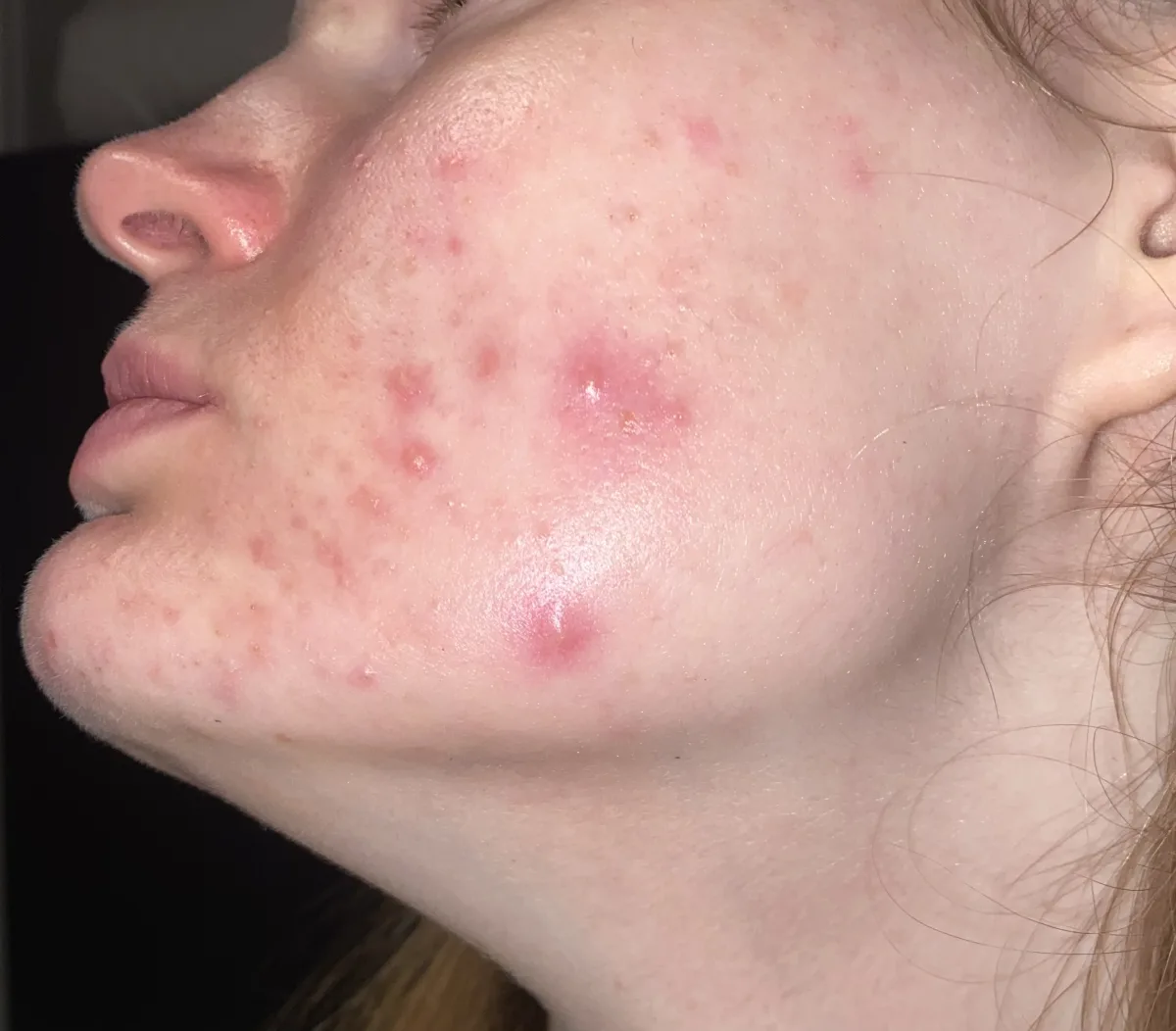 Retinol 0.2% in Squalane 30ml - before review image