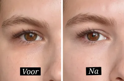 review image pretty-sharp-review-nars-soft-matte-concealer-voor-na_x6vweq