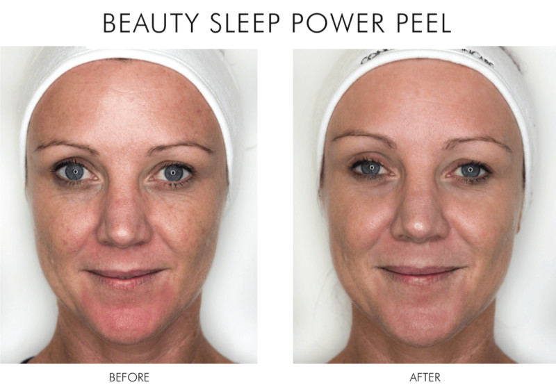 Alpha H Beauty Sleep Power Peel Alpha H We Are Eves